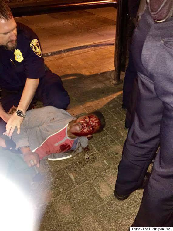 Black UVA Student Martese Johnson Bloodied During Arrest By State Liquor Agents