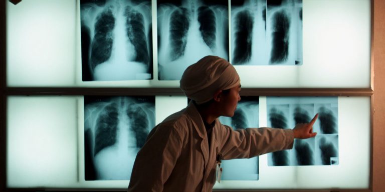 UN To Hold A Major Meeting On Tuberculosis, The Top Global Infectious Killer