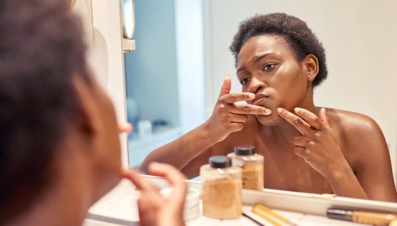 Do Pimple Patches Really Work?